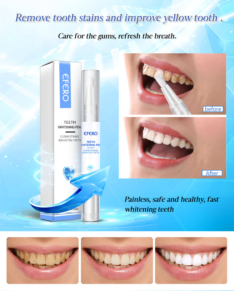 Stylo Blanchissant pour les Dents — Blanchiment Rapide & Éclat Naturel